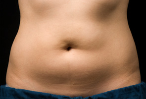 Before After Coolsculpting New Jersey Before and After | Skin Laser & Surgery Specialists of NY and NJ